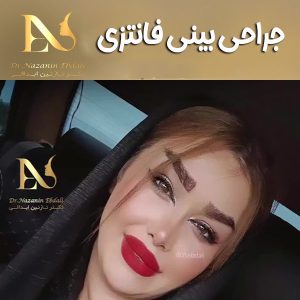 جراحی بینی فانتزی - دکتر ابدالی - drebdali.com