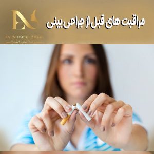 مراقبت های قبل از عمل بینی - دکتر نازنین ابدالی - drebdali.com