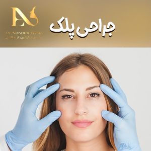 جراحی پلک - دکتر نازنین ابدالی - drebdali.com