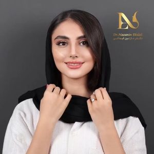 نمونه جراحی بینی نیمه فانتزی - دکتر نازنین ابدالی