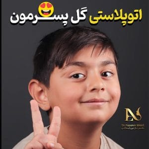 جراحی زیبایی گوش - دکتر نازنین ابدالی -drebdali.com