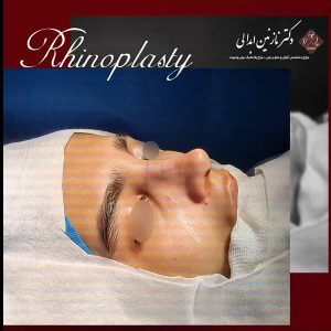 بلافاصله بعد از عمل 2- دکتر نازنین ابدالی