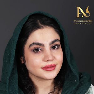 نمونه کار بهترین جراح بینی مشهد - دکتر نازنین ابدالی-drebdali.com
