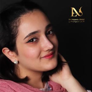 عکس عمل بینی طبیعی در مشهد - دکتر ابدالی-drebdali.com