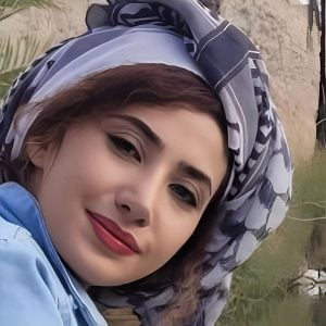 عکس جراحی بینی طبیعی در مشهد - دکتر ابدالی-drebdali.com