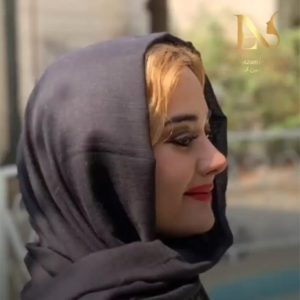 عکس عمل بینی استخوانی در مشهد - دکتر ابدالی