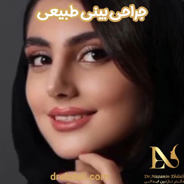 جراحی بینی طبیعی - دکتر نازنین ابدالی - drebdali.com