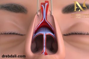 عکس جراحی بینی باز در مشهد - دکتر ابدالی - drebdali.com