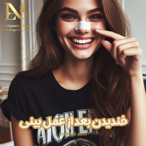 خندیدن بعد از عمل بینی - دکتر نازنین ابدالی - drebdali.com