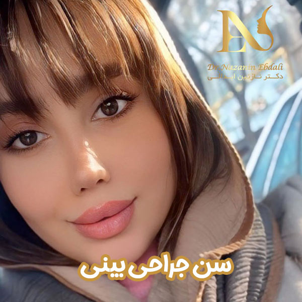 سن عمل بینی - دکتر ابدالی - drebdali.com