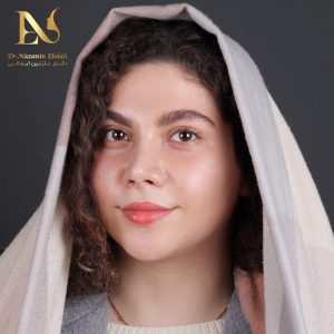 عکس نمونه کار جراحی یینی در سن مناسب - دکتر ابدالی - drebdali.com