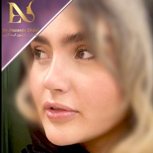 عکس جراح بینی نیمه فانتزی - دکتر ابدالی - drebdali.com