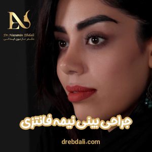 عمل بینی نیمه فانتزی - دکتر نازنین ابدالی - drebdali.com
