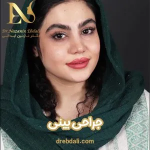 جراحی بینی در مشهد - دکتر نازنین ابدالی - drebdali.com