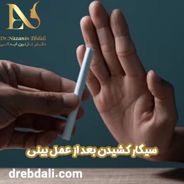سیگار کشیدن بعد از عمل بینی - دکتر نازنین ابدالی