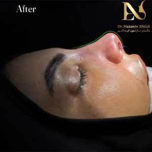 عمل زیبایی در مشهد - دکتر نازنین ابدالی - drebdali.com