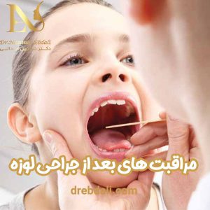 مراقبت های بعد از عمل لوزه - دکتر ابدالی - drebdali.com