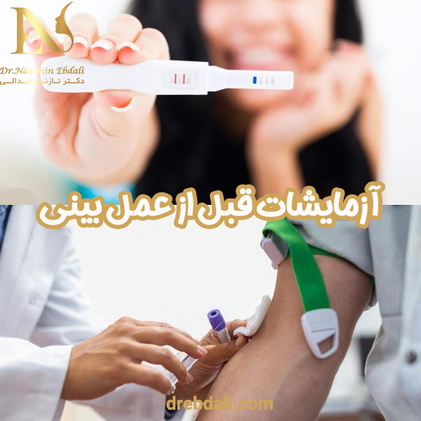 آزمایشات بعد از عمل بینی - دکتر نازنین ابدالی - drebdali.com