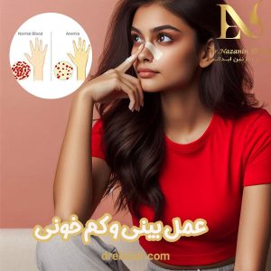 عمل بینی و کم خونی - دکتر ابدالی - drebdali.com