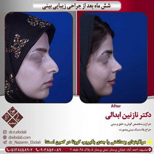 جراحی-بینی-400