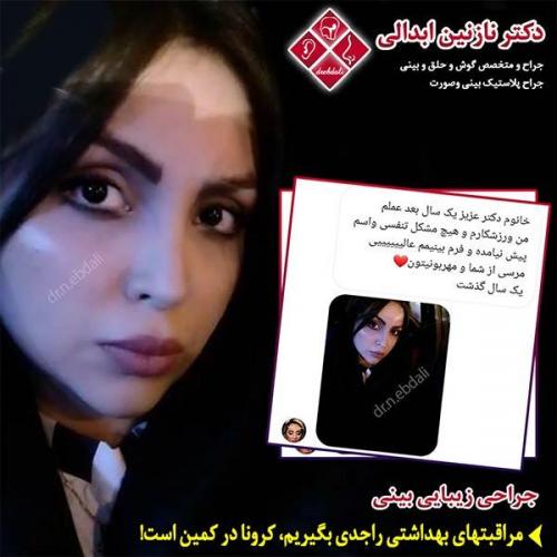 جراحی-بینی-مشهد-119