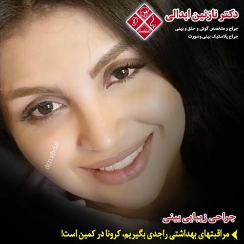 جراحی-بینی-مشهد-120