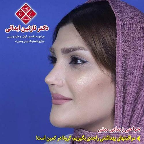 جراحی-بینی-مشهد-131