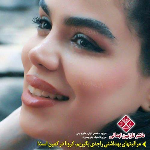 جراحی-بینی-مشهد-134