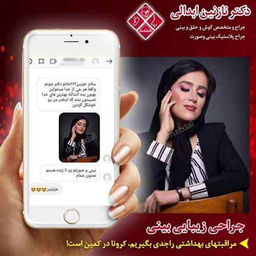 جراحی-بینی-مشهد-144