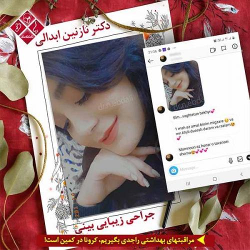جراحی-بینی-مشهد-146