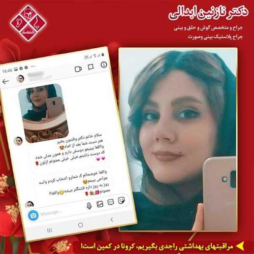 جراحی-بینی-مشهد-149
