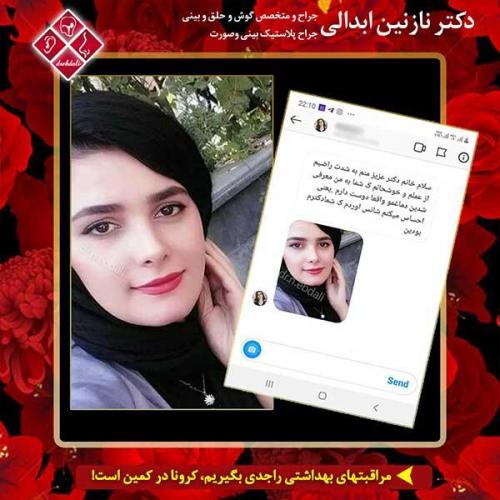 جراحی-بینی-مشهد-150