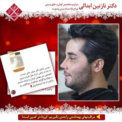 جراحی-بینی-مشهد-159