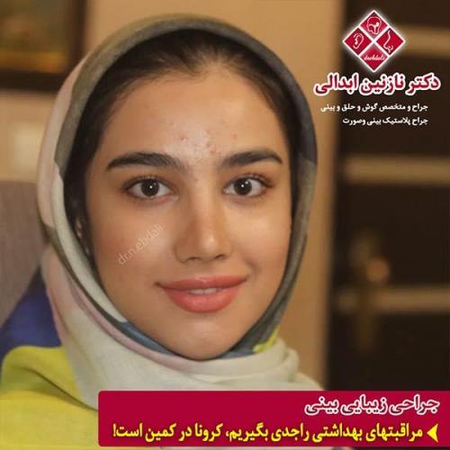 جراحی-بینی-مشهد-171
