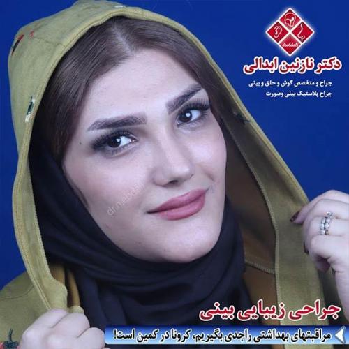 جراحی-بینی-مشهد-172