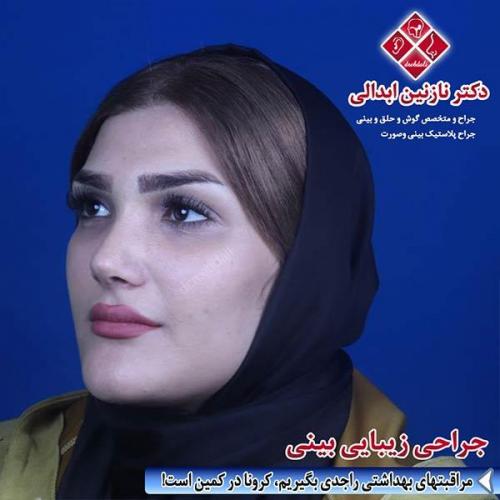 جراحی-بینی-مشهد-173