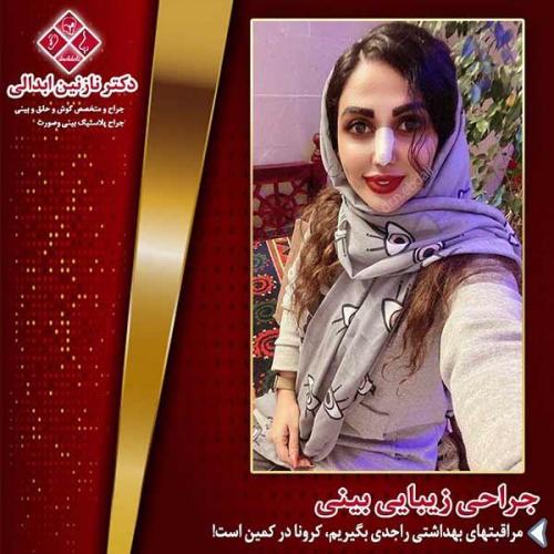 جراحی-بینی-مشهد-185