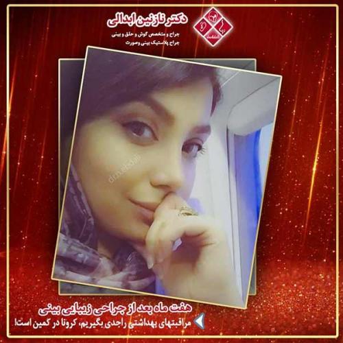 جراحی-بینی-مشهد-186