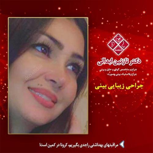 جراحی-بینی-مشهد-191