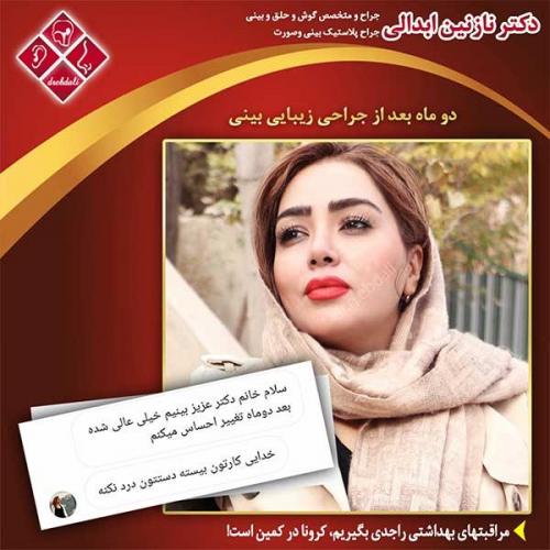 جراحی-بینی-مشهد-198