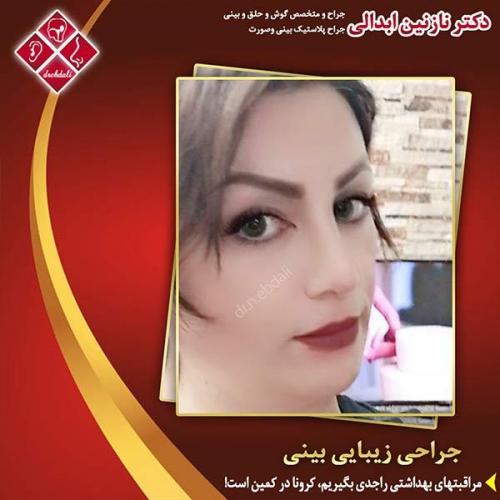 جراحی-بینی-مشهد-199