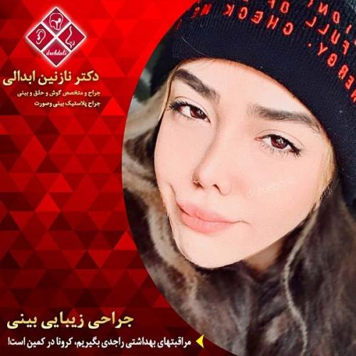 جراحی-بینی-مشهد-200