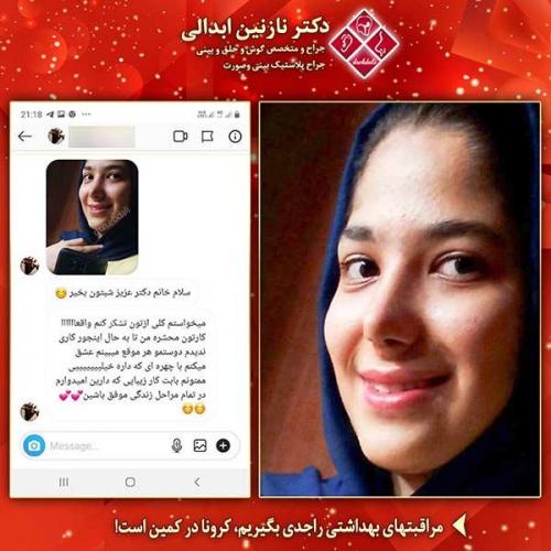جراحی-بینی-مشهد-214