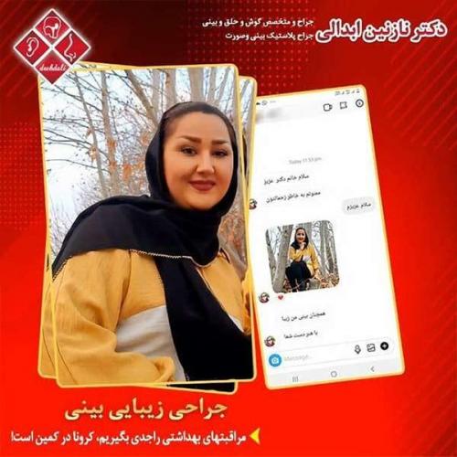 جراحی-بینی-مشهد-222