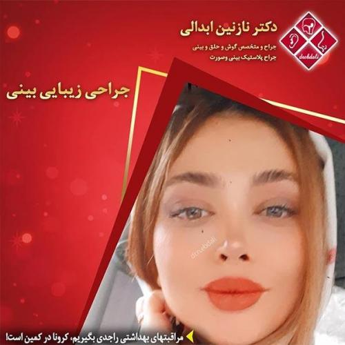جراحی-بینی-مشهد-225