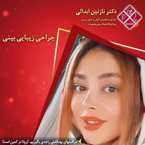 جراحی-بینی-مشهد-226
