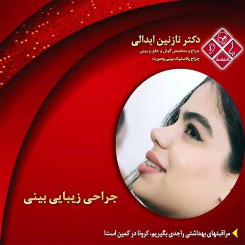 جراحی-بینی-مشهد-230