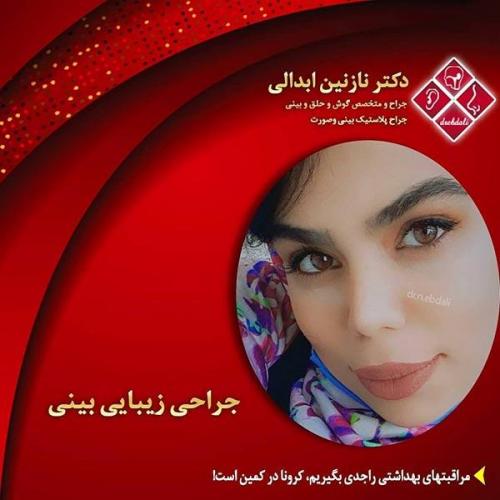جراحی-بینی-مشهد-231