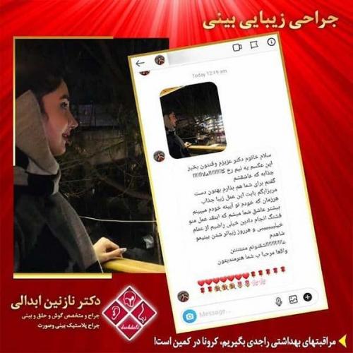 جراحی-بینی-مشهد-235