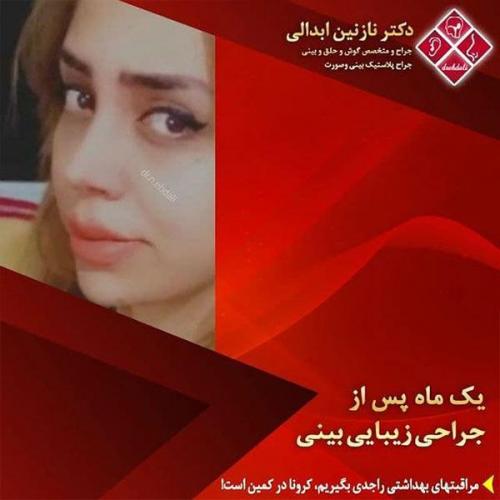 جراحی-بینی-مشهد-240